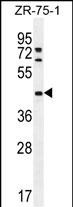 WB - METTL2 Antibody (C-term) AP11952b