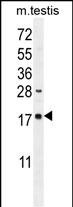 WB - DDIT3 Antibody (C-term A135) AP11955B