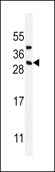 CD8B1 Antibody (C-term) (Cat. #AP11957b) western blot analysis in MDA-MB435 cell line lysates (35ug/lane).This demonstrates the CD8B1 antibody detected the CD8B1 protein (arrow).