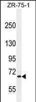 WB - LRRN3 Antibody (C-term) AP11970b