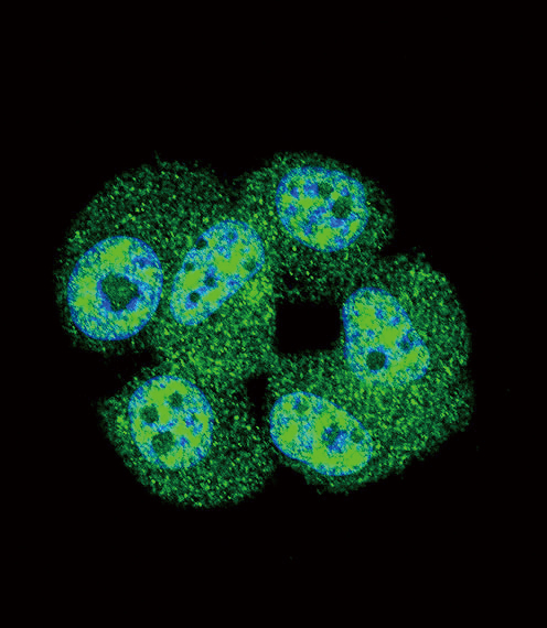 Confocal immunofluorescent analysis of AKT1 Antibody (C-term T450)(Cat#AP11976a) with MCF-7 cell followed by Alexa Fluor 488-conjugated goat anti-rabbit lgG (green).DAPI was used to stain the cell nuclear (blue).