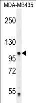 PCDHA5 Antibody (Center) (Cat. #AP12003c) western blot analysis in MDA-MB435 cell line lysates (35ug/lane).This demonstrates the PCDHA5 antibody detected the PCDHA5 protein (arrow).