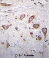 IHC-P - PLCL2 Antibody (C-term) AP12004b