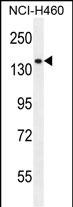 WB - PLCL2 Antibody (C-term) AP12004b