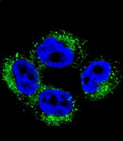 Confocal immunofluorescent analysis of AP1M1 Antibody (Center)(Cat#AP12036c) with A375 cell followed by Alexa Fluor 488-conjugated goat anti-rabbit lgG (green). DAPI was used to stain the cell nuclear (blue).