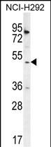 WB - SH2D4A Antibody (N-term) AP12049A