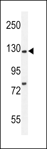 WB - Kif5C-2 Antibody AP12055a