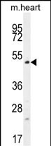 WB - TSPYL4 Antibody (C-term) AP12092b