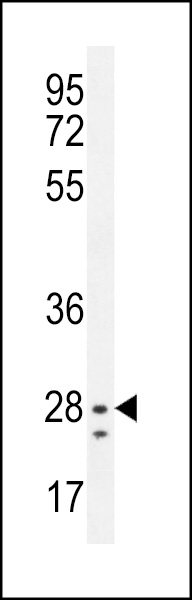 WB - NIPSNAP3B Antibody (C-term) AP12094b