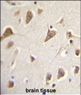 IHC-P - ZMYND10 Antibody (Center) AP12098c