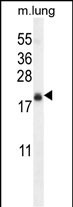 WB - TMEM80 Antibody (Center) AP12103c