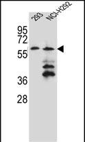 WB - PRAMEF12 Antibody (Center) AP12129c