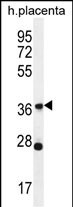 WB - OR4L1 Antibody (C-term) AP12134b