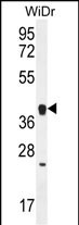 WB - OR2T8 Antibody (C-term) AP12137b
