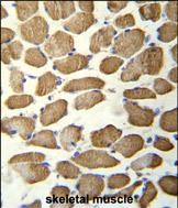 IHC-P - KBTBD13 Antibody (C-term) AP12139b