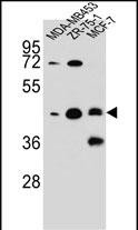 WB - KBTBD13 Antibody (C-term) AP12139b