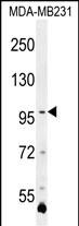 PCDHA3 Antibody (C-term) (Cat. #AP12144b) western blot analysis in MDA-MB231 cell line lysates (35ug/lane).This demonstrates the PCDHA3 antibody detected the PCDHA3 protein (arrow).