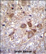 IHC-P - SPECC1 Antibody (Center) AP12147c