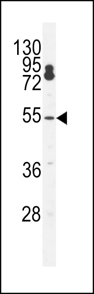 CPSF7 Antibody (C-term) (Cat. #AP12151b) western blot analysis in K562 cell line lysates (35ug/lane).This demonstrates the CPSF7 antibody detected the CPSF7 protein (arrow).