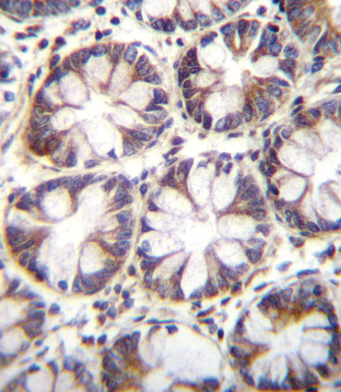 IHC-P - SLC36A1 Antibody (N-term) AP12170A