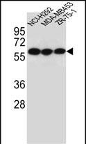 CHRNA10 Antibody (Center) (Cat. #AP12186c) western blot analysis in NCI-H292,MDA-MB453,ZR-75-1 cell line lysates (35ug/lane).This demonstrates the CHRNA10 antibody detected the CHRNA10 protein (arrow).