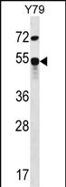 WB - ZFP14 Antibody (N-term) AP12208a