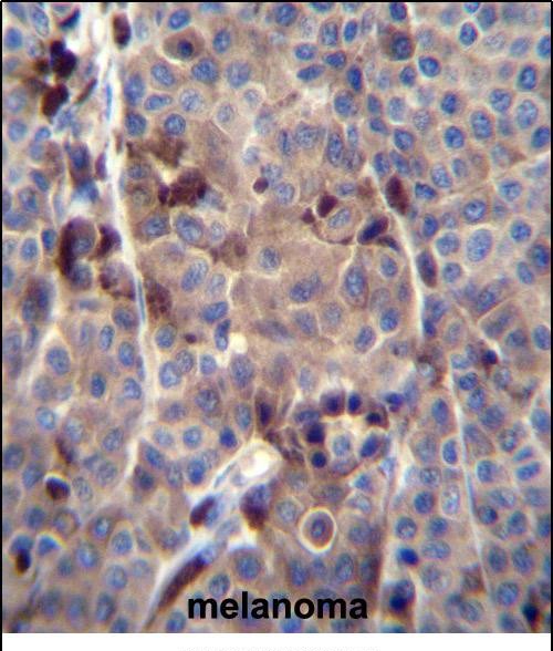 IHC-P - PRAMEF8 Antibody (C-term) AP12211b