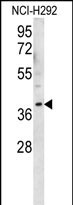 WB - OR2AK2 Antibody (C-term) AP12212b
