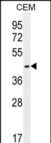 WB - OR8H2/OR8H3 Antibody (C-term) AP12218b