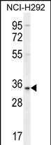 SFTPA2B Antibody (C-term) (Cat. #AP12232b) western blot analysis in NCI-H292 cell line lysates (35ug/lane).This demonstrates the SFTPA2B antibody detected the SFTPA2B protein (arrow).