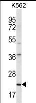 HLA-DQA1 Antibody (Center) (Cat. #AP12234c) western blot analysis in K562 cell line lysates (35ug/lane).This demonstrates the HLA-DQA1 antibody detected the HLA-DQA1 protein (arrow).