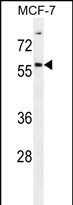 WB - ZNF165 Antibody (Center) AP12252c
