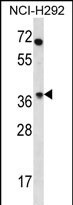 WB - OR4N2 Antibody (N-term) AP12274a