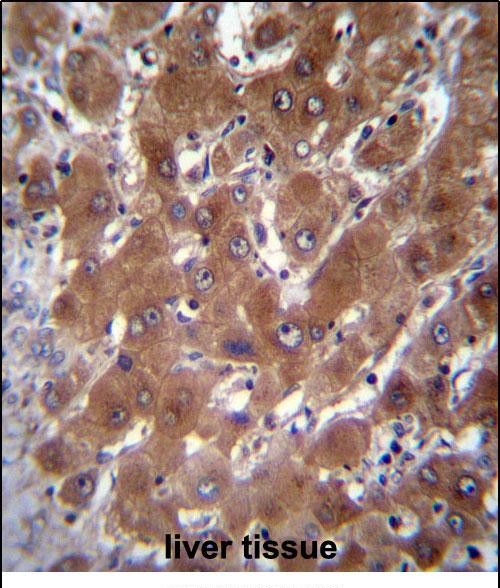 IHC-P - GBA3 Antibody (C-term) AP12289B