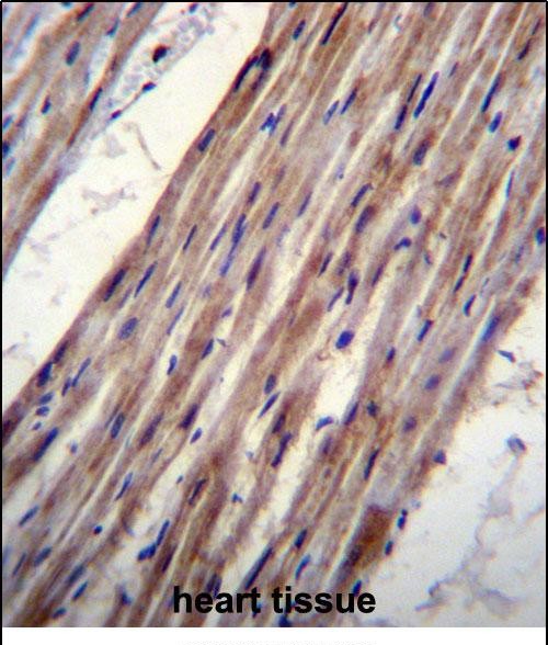 IHC-P - KCNJ8 Antibody (N-term) AP12302a