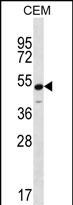 WB - KCNJ8 Antibody (N-term) AP12302a