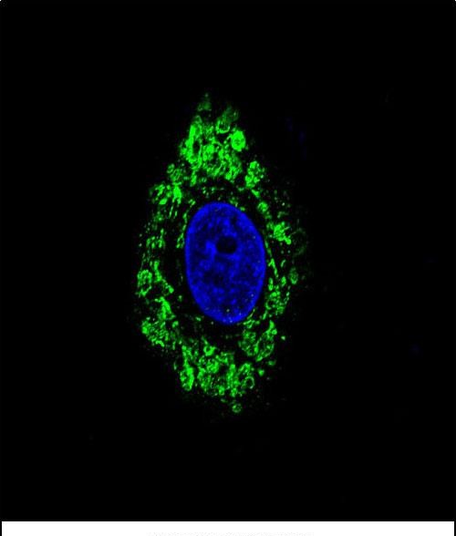 Confocal immunofluorescent analysis of DVL1 Antibody (Center) (Cat#AP12326c) with HepG2 cell followed by Alexa Fluor 488-conjugated goat anti-rabbit lgG (green). DAPI was used to stain the cell nuclear (blue).
