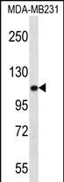 ACTN3 Antibody (Center) (Cat. #AP12327c) western blot analysis in MDA-MB231 cell line lysates (35ug/lane).This demonstrates the ACTN3 antibody detected the ACTN3 protein (arrow).