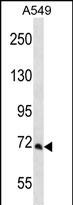 PCCA Antibody (Center) (Cat. #AP12328c) western blot analysis in A549 cell line lysates (35ug/lane).This demonstrates the PCCA antibody detected the PCCA protein (arrow).