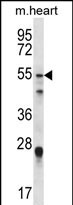 WB - FOXO6 Antibody (Center) AP12340C
