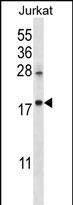 WB - KRTAP25-1 Antibody (C-term) AP12354b