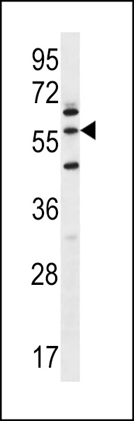 WB - LETM2 Antibody (N-term) AP12360a