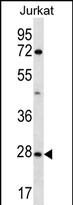 WB - OR6T1 Antibody (C-term) AP12371b