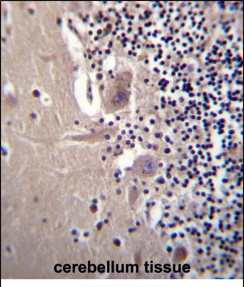 IHC-P - CRYBA1 Antibody (Center) AP12377c