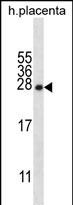 WB - CRYBA1 Antibody (Center) AP12377c