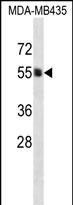 PIGA Antibody (C-term) (Cat. #AP12378b) western blot analysis in MDA-MB435 cell line lysates (35ug/lane).This demonstrates the PIGA antibody detected the PIGA protein (arrow).