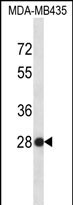 WB - SNRPB2 Antibody (N-term) AP12381a
