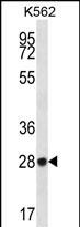 ZNF146 Antibody (N-term) (Cat. #AP12388a) western blot analysis in K562 cell line lysates (35ug/lane).This demonstrates the ZNF146 antibody detected the ZNF146 protein (arrow).