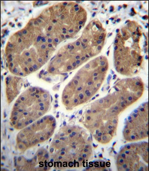IHC-P - TM181 Antibody (N-term) AP12403a