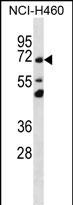 WB - TM181 Antibody (N-term) AP12403a